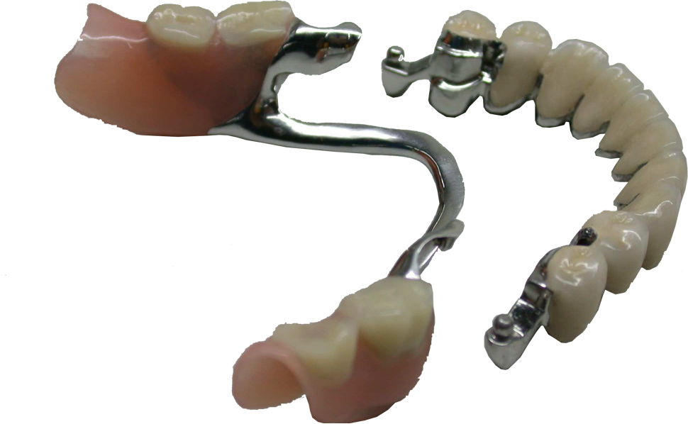 Attachements dentaires